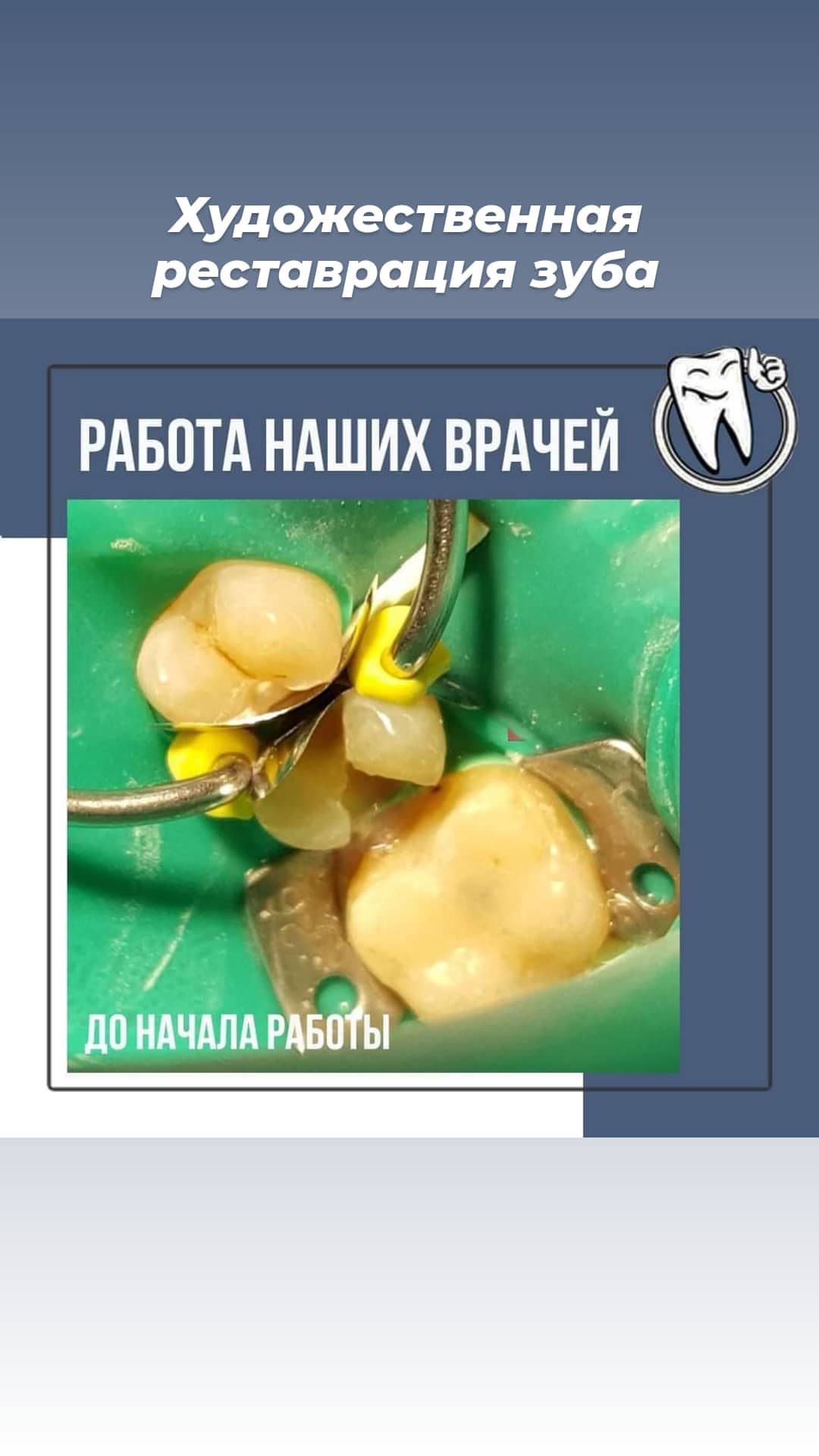 Результат лечения